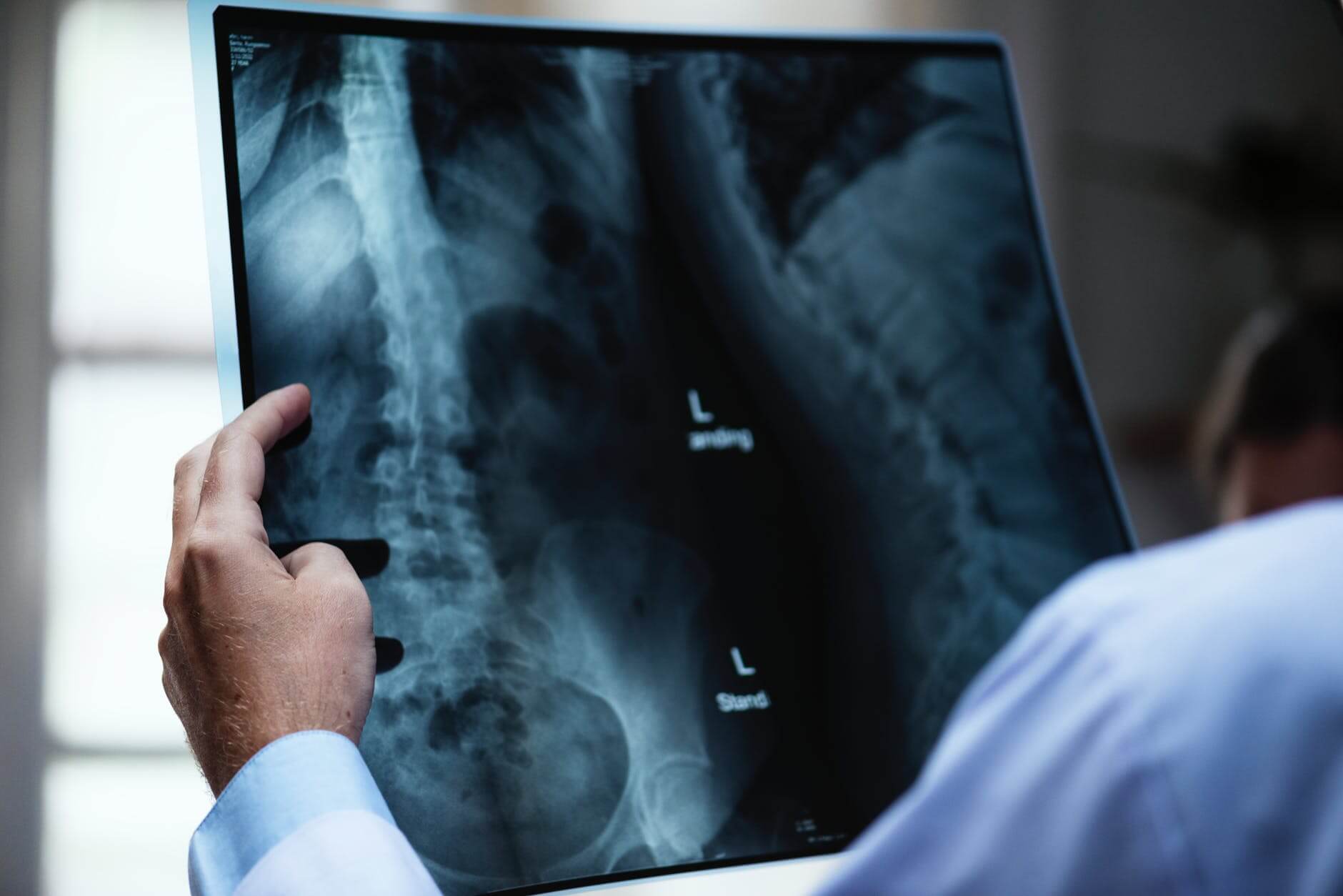 Radiografias para avaliação de dor nas costas